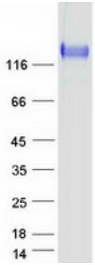 Coomassie blue staining of purified ITGA5 protein.